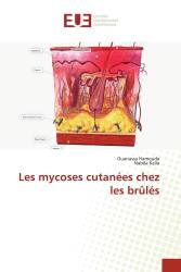 Les mycoses cutanées chez les brûlés