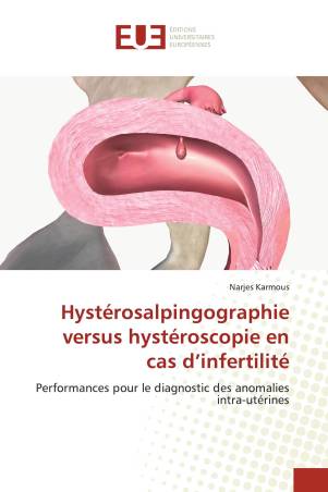 Hystérosalpingographie versus hystéroscopie en cas d’infertilité